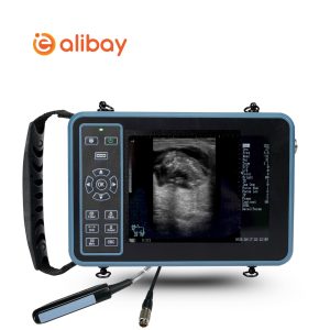 Ultrashound System