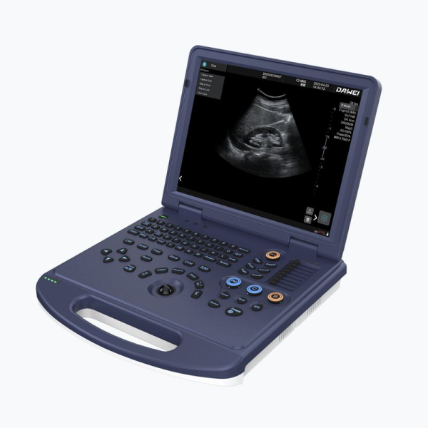 L30i-VET Veterinary Color Doppler Ultrasound System - Image 5